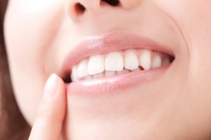 cosmetic_dentistry_img001