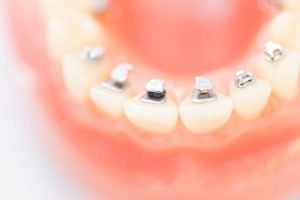 cosmetic_dentistry_img002